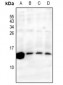 Anti-RPS27L Antibody
